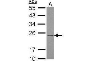 WB Image Sample (30 ug of whole cell lysate) A: HepG2 12% SDS PAGE antibody diluted at 1:1000 (RAB3B Antikörper)