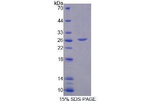SDS-PAGE analysis of Human MCCC2 Protein.