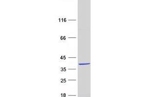 Western Blotting (WB) image for Chromosome 10 Open Reading Frame 96 (C10orf96) protein (Myc-DYKDDDDK Tag) (ABIN2715379)