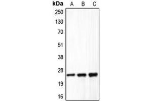 Western blot analysis of Claudin 5 expression in HeLa (A), mouse liver (B), rat lung (C) whole cell lysates. (Claudin 5 Antikörper  (C-Term))