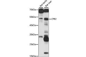 Western blot analysis of extracts of various cell lines, using CPB2 antibody (ABIN7266081) at 1:1000 dilution. (CPB2 Antikörper  (AA 310-410))