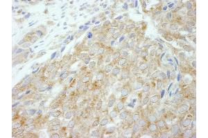 anti-Flightless I Homolog (FLII) (AA 425-475) antibody