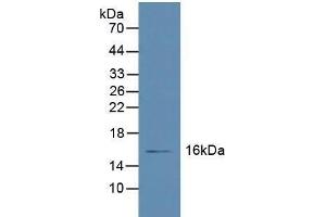 Western blot analysis of Human Liver Tissue. (Retinol Binding Protein 5 Antikörper  (AA 2-135))