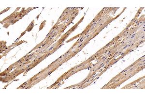 Detection of AST2 in Rat Cardiac Muscle Tissue using Polyclonal Antibody to Aspartate Aminotransferase 2 (AST2) (GOT2 Antikörper  (AA 30-430))