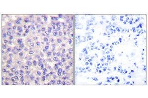 Immunohistochemistry (IHC) image for anti-Transforming Growth Factor, beta 3 (TGFB3) (Internal Region) antibody (ABIN1848799) (TGFB3 Antikörper  (Internal Region))