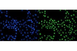 IF analysis of EXOSC3 using anti-EXOSC3 antibody (ABIN7602216). (EXOSC3 Antikörper  (AA 64-275))