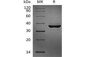 Western Blotting (WB) image for Fibrinogen-Like 1 (FGL1) protein (His tag,Biotin) (ABIN7321022) (FGL1 Protein (His tag,Biotin))