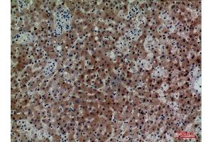 Immunohistochemistry (IHC) image for anti-CD7 (CD7) (Internal Region) antibody (ABIN6283931)