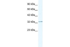 NUDT9 antibody used at 1. (NUDT9 Antikörper)