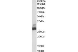 ABIN185447 (0. (SDHB Antikörper  (C-Term))