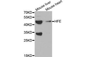 Western blot analysis of extracts of various cell lines, using HFE antibody.