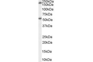 Western Blotting (WB) image for anti-Serotonin Receptor 3A (HTR3A) (Internal Region) antibody (ABIN2466257) (Serotonin Receptor 3A Antikörper  (Internal Region))