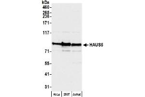 anti-HAUS Augmin-Like Complex, Subunit 5 (HAUS5) (AA 75-125) antibody