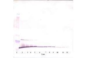 Image no. 2 for anti-Melanoma Inhibitory Activity (MIA) antibody (ABIN464851) (MIA Antikörper)