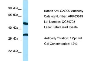 Western Blotting (WB) image for anti-Calsequestrin 2 (CASQ2) (N-Term) antibody (ABIN970293) (CASQ2 Antikörper  (N-Term))