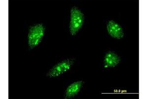 Immunofluorescence of monoclonal antibody to MEOX2 on HeLa cell. (MEOX2 Antikörper  (AA 1-303))