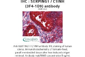 Image no. 2 for anti-Serpin Peptidase Inhibitor, Clade G (C1 Inhibitor), Member 1 (SERPING1) (AA 1-501), (full length) antibody (ABIN1723814) (SERPING1 Antikörper  (full length))