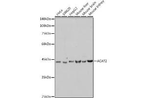Western blot analysis of extracts of various cell lines, using  antibody (ABIN7265364) at 1:1000 dilution. (ACAT2 Antikörper)