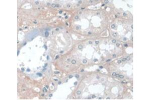 DAB staining on IHC-P Samples:Human Kidney Tissue) (APOA1 Antikörper  (AA 122-267))