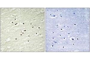 Immunohistochemistry analysis of paraffin-embedded human brain tissue, using Cyclin H (Ab-315) Antibody. (Cyclin H Antikörper  (AA 274-323))