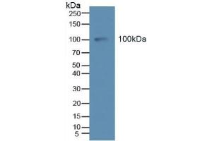 Detection of Tie2 in Human Serum using Polyclonal Antibody to TEK Tyrosine Kinase, Endothelial (Tie2) (TEK Antikörper  (AA 286-465))