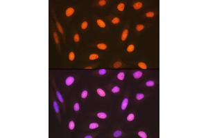 Immunofluorescence analysis of U-2 OS cells using HMGB2 Rabbit mAb (ABIN7267649) at dilution of 1:100 (40x lens). (HMGB2 Antikörper)