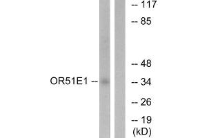 Western blot analysis of extracts from HeLa cells, using OR51E1 antibody. (OR51E1 Antikörper  (C-Term))