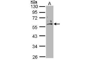 WB Image Sample (30 ug of whole cell lysate) A: A431 , (Keratin 2 Antikörper)