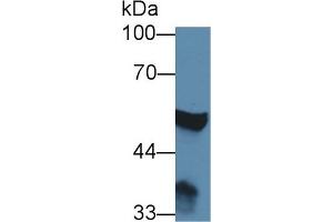 Detection of ABAT in Rat Cerebrum lysate using Polyclonal Antibody to 4-Aminobutyrate Aminotransferase (ABAT)