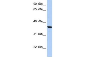 PSTK antibody used at 1 ug/ml to detect target protein. (PSTK Antikörper  (Middle Region))