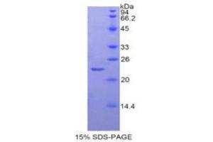 SDS-PAGE (SDS) image for Paraoxonase 1 (PON1) (AA 2-186) protein (His tag) (ABIN1877258) (PON1 Protein (AA 2-186) (His tag))