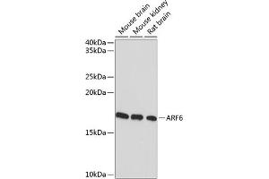 Western blot analysis of extracts of various cell lines, using  Rabbit mAb (ABIN7265485) at 1:1000 dilution. (ARF6 Antikörper)
