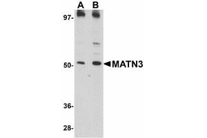 Image no. 1 for anti-Matrilin 3 (MATN3) (C-Term) antibody (ABIN478072) (Matrilin 3 Antikörper  (C-Term))