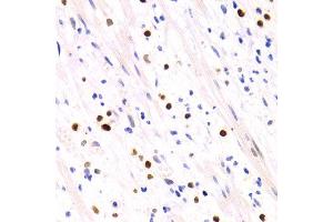 Immunohistochemistry of paraffin-embedded human appendicitis using GEMIN2 antibody at dilution of 1:200 (400x lens). (SIP1 Antikörper)