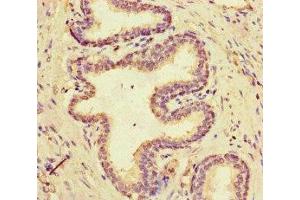 Immunohistochemistry of paraffin-embedded human prostate cancer using ABIN7160306 at dilution of 1:100 (Multicilin Antikörper  (AA 3-110))