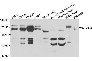 Western blot analysis of extracts of various cell lines, using GALNT2 antibody (ABIN5974158) at 1/1000 dilution. (GALNT2 Antikörper)