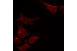 ABIN6275055 staining HepG2 by IF/ICC. (DHRS4 Antikörper  (C-Term))