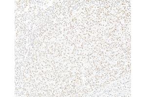 Immunohistochemistry (IHC) image for anti-Enhancer of Zeste Homolog 2 (EZH2) (C-Term) antibody (ABIN7795724)