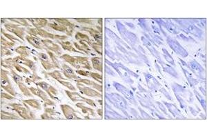 Immunohistochemistry (IHC) image for anti-Mitochondrial Ribosomal Protein L39 (MRPL39) (AA 289-338) antibody (ABIN2890417)