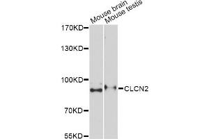 Western blot analysis of extracts of various cell lines, using CLCN2 Antibody. (CLCN2 Antikörper)