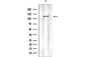 Western blot analysis of lysates from K562 cells(serum starvation treatment), using EPHA1 Mouse Monoclonal Antibody at 1/1000 dilution.
