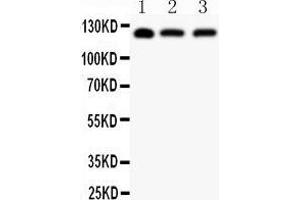 Anti-SIRT1 Picoband antibody,  All lanes: Anti SIRT1  at 0. (SIRT1 Antikörper  (AA 112-311))