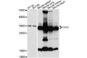 Western blot analysis of extracts of various cell lines, using CA13 antibody (ABIN6292753) at 1:3000 dilution. (CA13 Antikörper)