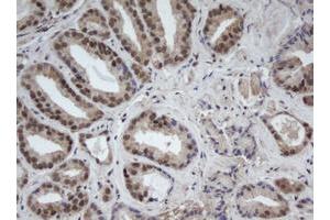 Image no. 1 for anti-Cullin 4B (CUL4B) (AA 1-300) antibody (ABIN1490724) (Cullin 4B Antikörper  (AA 1-300))