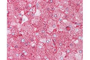 Anti-MINK1 / MAP4K6 antibody IHC of human liver. (MAP4K6 Antikörper  (Internal Region))