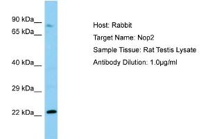 WB Suggested Anti-Nop2 Antibody   Titration: 1. (Nucleolar Protein 1 (NOL1) (N-Term) Antikörper)