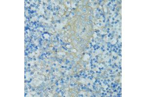 Immunohistochemistry of paraffin-embedded human tonsil using TJP2 antibody (ABIN5970222) at dilution of 1/100 (40x lens).