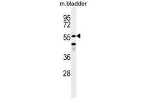 Western Blotting (WB) image for anti-SHQ1 Homolog (SHQ1) antibody (ABIN2996338) (SHQ1 Antikörper)