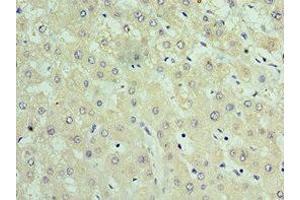Immunohistochemistry of paraffin-embedded human liver tissue using ABIN7159904 at dilution of 1:100 (TIMM21 Antikörper  (AA 1-248))