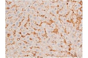 ABIN6267525 at 1/200 staining Rat liver tissue sections by IHC-P.
